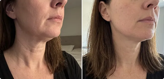 myoglow results